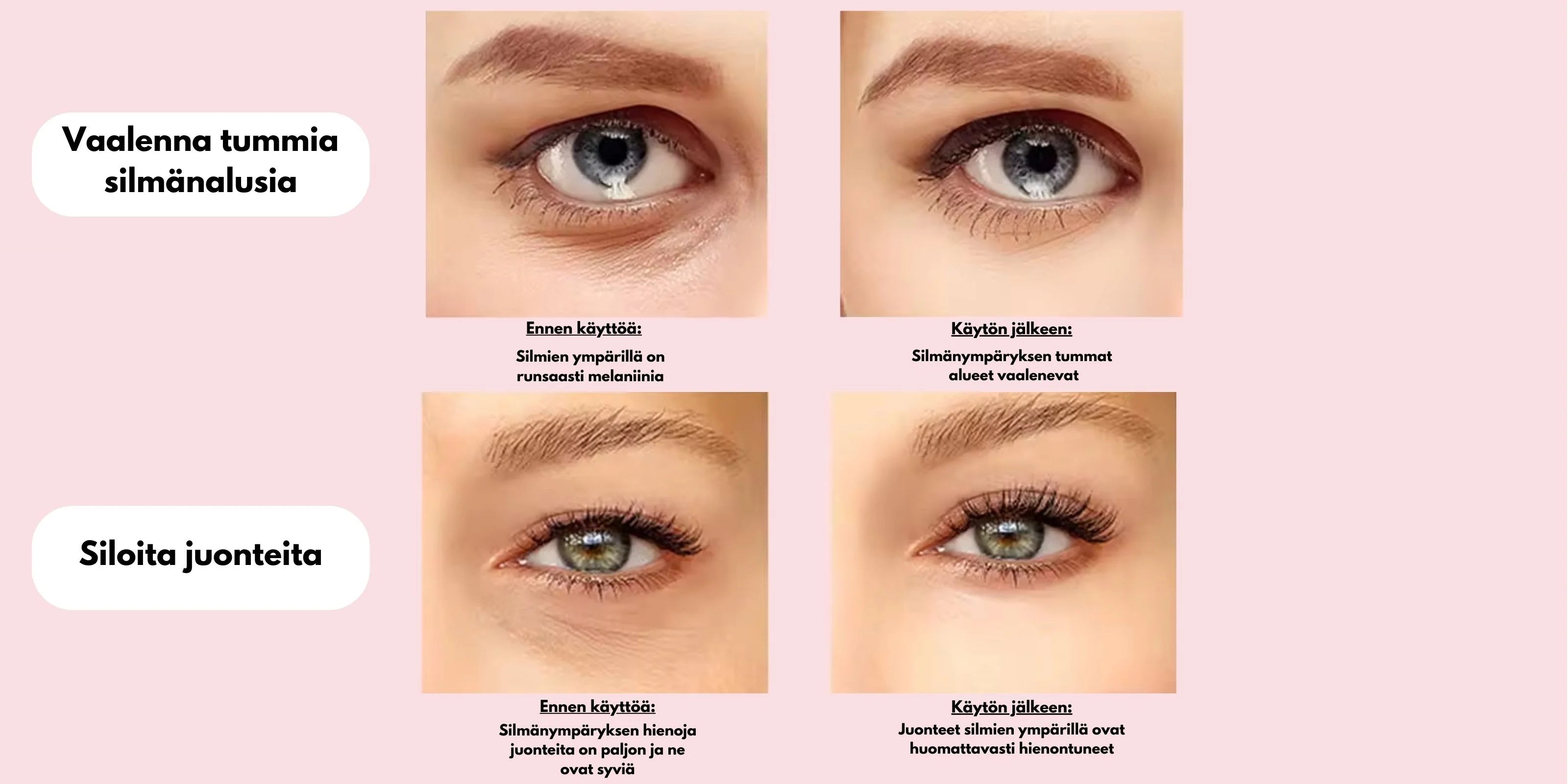 Punavalosauva siloittaa juonteita ja vaalentaa tummia silmänalusia.