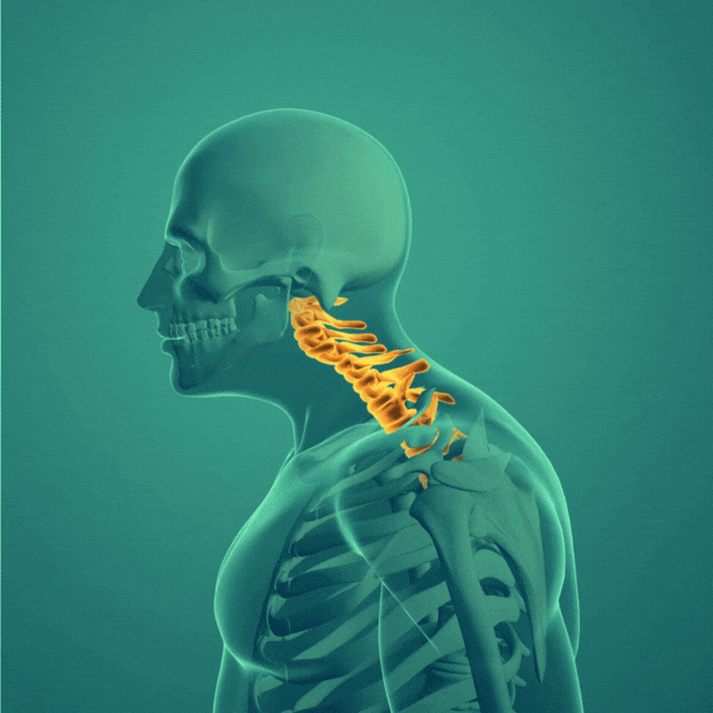 Niskakaari parantaa niskan asentoa ja vähentää kipuja luonnollisesti.